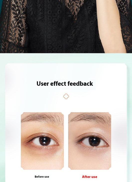 Limpiador Facial Poro Eléctrico Efecto Calor - Image 15