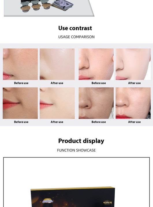Máquina Facial Oxigenación Burbujas Grandes - Limpieza Profunda, Firmeza y Antiarrugas - Image 15