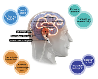Dispositivo Inteligente para Mejorar el Sueño Profundo - Image 10
