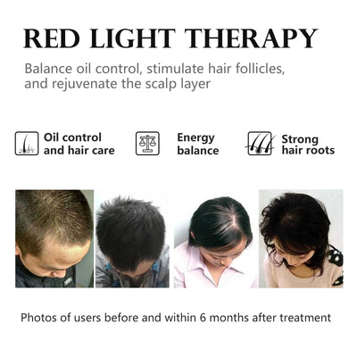 Dispositivo de Fototerapia LED para Rejuvenecimiento Facial y Tratamiento del Acné - Image 12