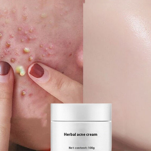 Crema Herbácea Aclarant para Acné y Manchas