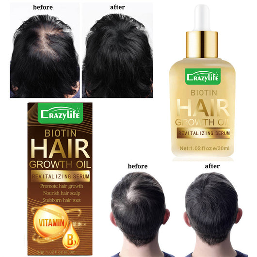 Aceite Esencial para Cabello 30ml - Suavidad y Frescura Instantánea - Image 5