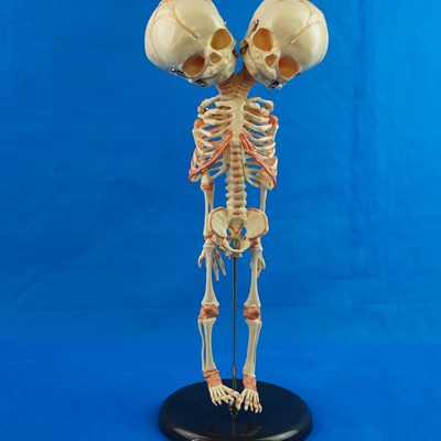 Modelo Anatómico Doble de Hueso Infantil para Enseñanza Médica - Image 9