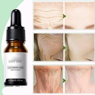 Ácido Lactobiónico Bilin - Exfoliante Suave de Nueva Generación - Image 14