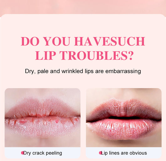 Exfoliante Labial con Sabores Frutales - Hidratación y Nutrición Intensas - Image 25