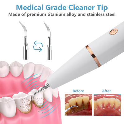 Removedor Ultrasónico de Sarro Dental Eléctrico Profesional - Image 6