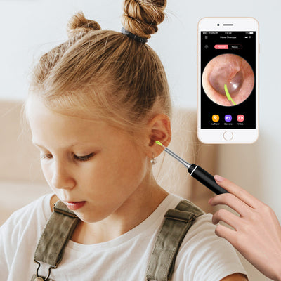 Otoscopio Inalámbrico con Luz LED y Función de Limpieza Auricular - Image 10