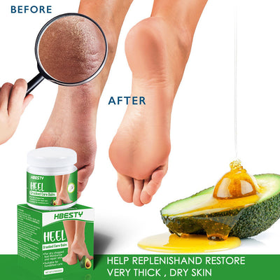 Crema Regeneradora para Talones Agrietados con Aguacate - Image 4