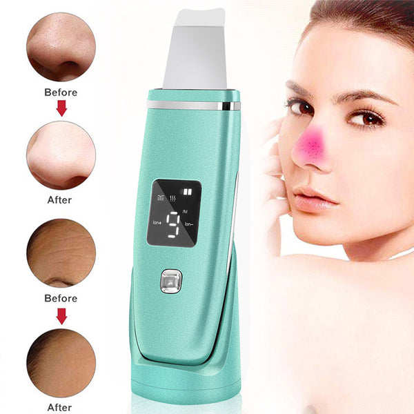 Limpiador Ultrasónico de Poros con LED - Removedor de Puntos Negros y Lifting Facial