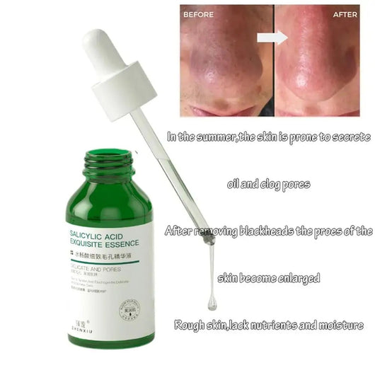 Sérum Salicílico Reductor de Poros - Elimina Puntos Negros y Repara Marcas de Acné - Image 12
