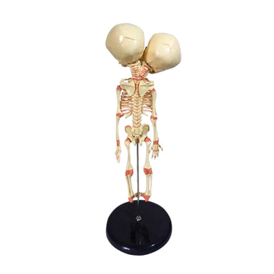 Modelo Anatómico Doble de Hueso Infantil para Enseñanza Médica - Image 6