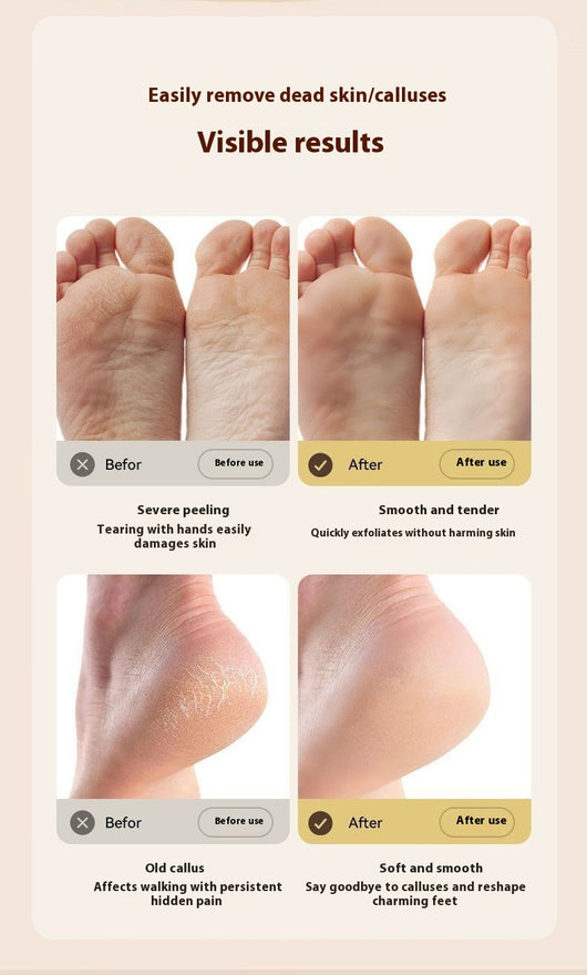 Ivory white electric foot grinder with digital display, power button, and three interchangeable grinding heads. - Image 11