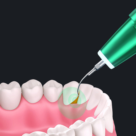 Removedor Ultrasónico de Sarro Dental Profesional - Image 10
