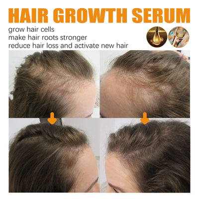 Aceite Esencial Reparador para el Crecimiento del Cabello - Image 12