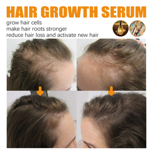 Aceite Esencial Reparador para el Crecimiento del Cabello - Image 12
