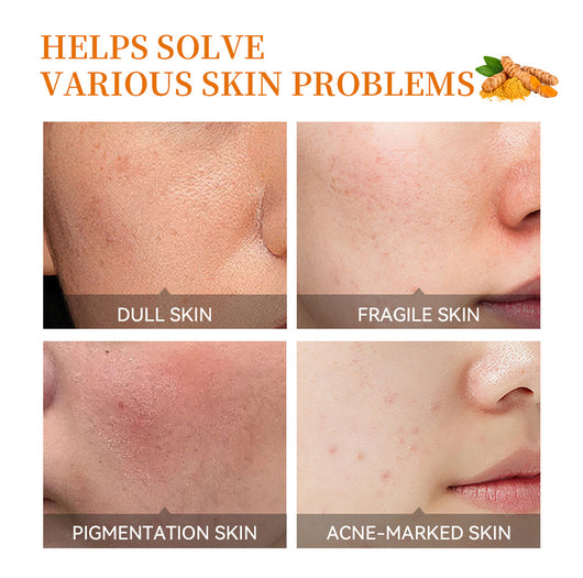 Set Completo de Cuidado Facial con Cúrcuma e Hidratación Profunda - Image 14