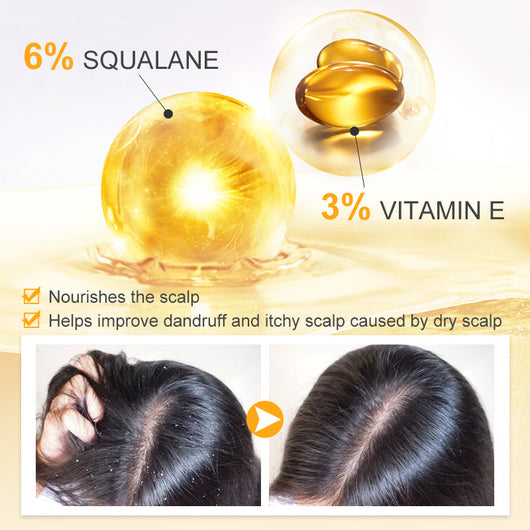 Aceite Esencial para Cabello Suave y Brillante - Image 4