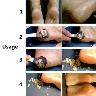 Cepillo Multiusos de Acero Inoxidable para Pies - Image 14