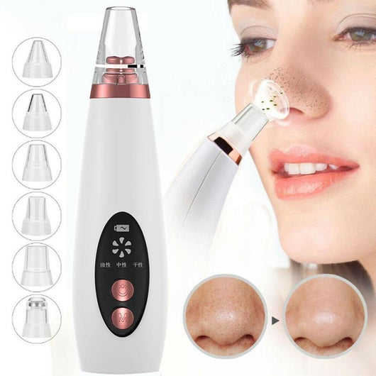Limpiador de Poros con Succión Facial - Removedor de Puntos Negros y Acné