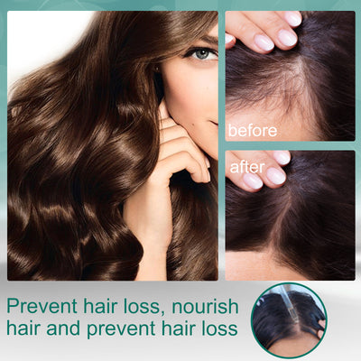Aceite Esencial Fortalecedor de Jengibre Maduro para el Cabello - Image 16