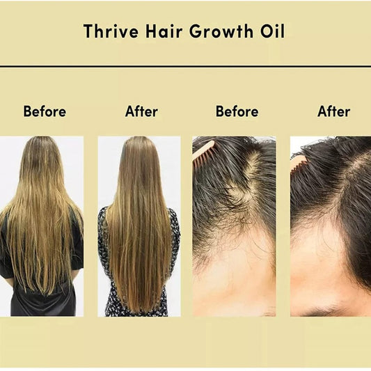 Aceite Esencial Nutritivo de Romero para Cabello Suave - Image 2