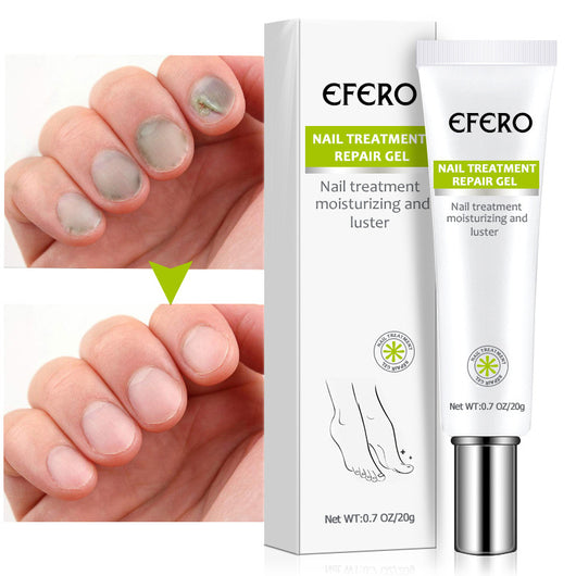 Líquido Gel para Uñas de Base Natural