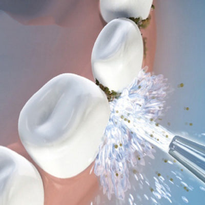Limpiador Ultrasónico Portátil para Dientes - Image 10