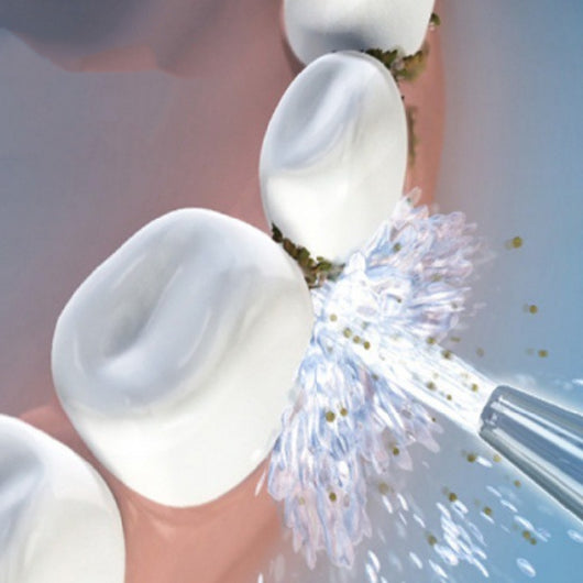 Limpiador Ultrasónico Portátil para Dientes - Image 10