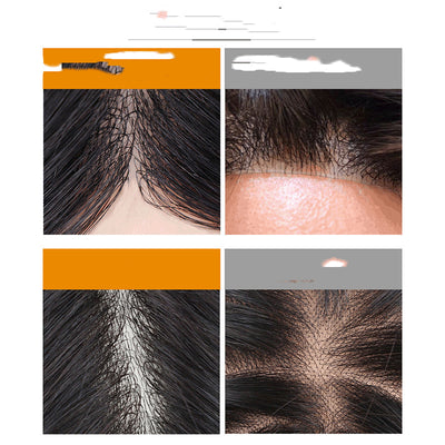Sistema de Cobertura Capilar Biosintético Transpirable para Hombres - Image 3
