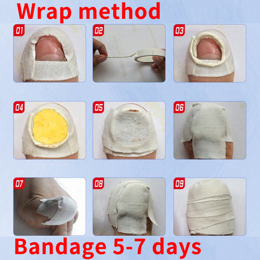 Removedor de Cutículas y Callos - Herramienta Profesional para Pedicura - Image 2