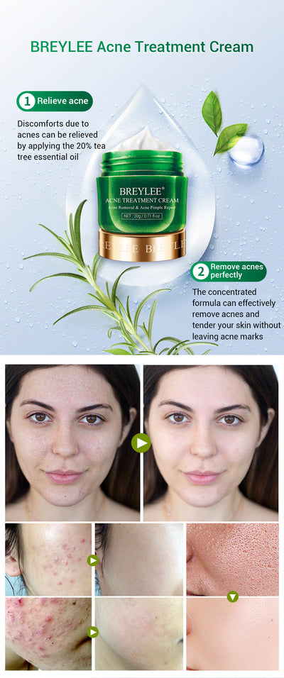 Crema Facial de Árbol de Té BREYLEE - Tratamiento Anti-Acné y Cicatrices - Image 17