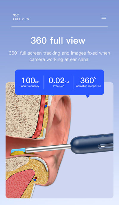 Blue wireless ear endoscope with camera, displaying an ear canal view on a smartphone, with various silicone ear spoon heads, charging cable, and storage jar. - Image 17