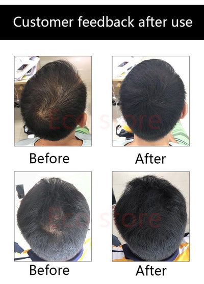 Polvo Densificador para Cabello - Relleno de Línea Capilar Instantáneo - Image 6