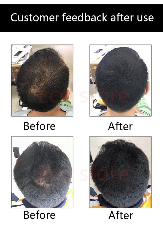 Polvo Densificador para Cabello - Relleno de Línea Capilar Instantáneo - Image 6