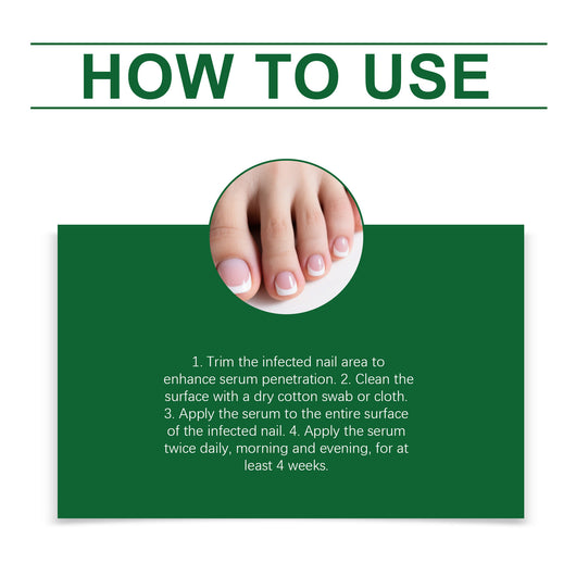 Solución de Cuidado de Uñas con Jengibre - Image 14