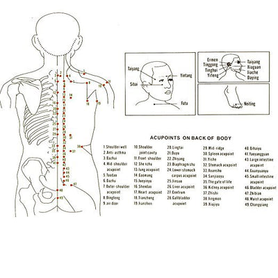 Ventosas de Silicona para Masaje y Terapia - Image 13