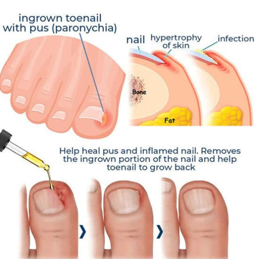 Aceite Reparador de Uñas Engrosado - Tratamiento para Surcos y Grietas - Image 18