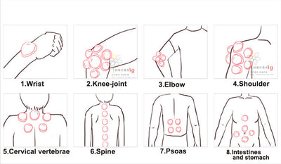 Ventosas de Silicona para Masaje y Terapia - Image 16