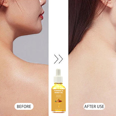 Aceite Esencial de Cúrcuma y Miel 30ml - Image 10