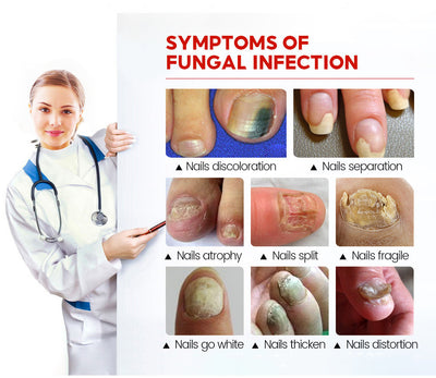 Solución Integral para Hongos en Uñas - Aceite Esencial Esterilizante - Image 17