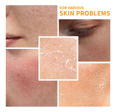 Set Completo de Cuidado Facial con Vitamina C - Image 11