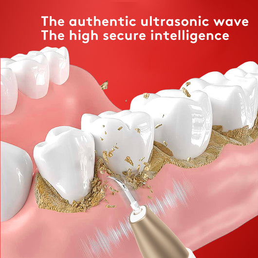 White and gold ultrasonic tooth cleaner with a pointed metal tip, standing in a white charging base. - Image 5