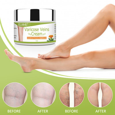 Crema Correctora de Estrías y Venas - Image 8