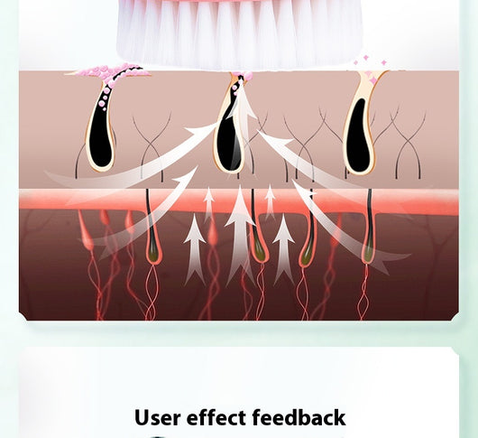 Limpiador Facial Poro Eléctrico Efecto Calor - Image 19