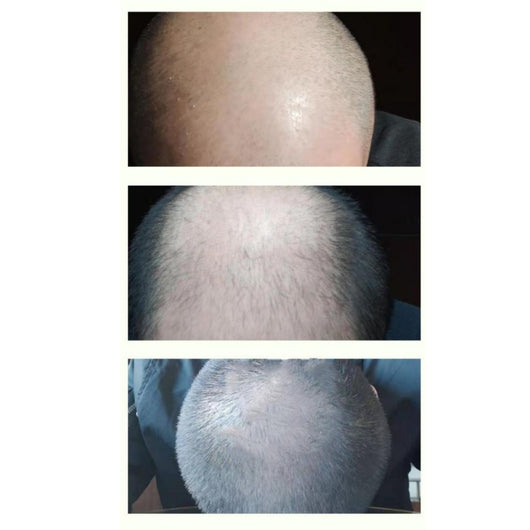 Champú Anticaspa con Reparación y Nutrición Intensiva - Image 9