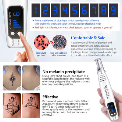 Dispositivo Láser Picosegundo para Eliminar Tatuajes, Cicatrices y Manchas de la Piel - Image 17