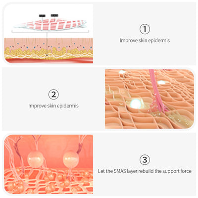 Dispositivo de Lifting Facial Ultrasónico V-Face Anti-envejecimiento - Image 15